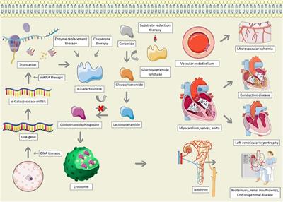 Anderson-Fabry disease cardiomyopathy: an update on epidemiology, diagnostic approach, management and monitoring strategies